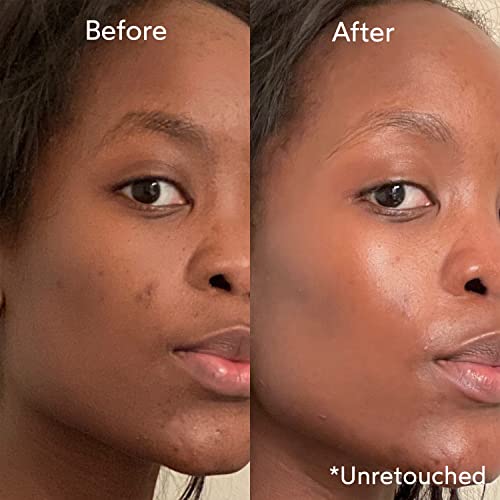 True Botanicals Natural Chebula Active Serum + Ilia Blue Light Face Mist Value Bundle | Clean, Non-Toxic, Natural Skincare #TOP4