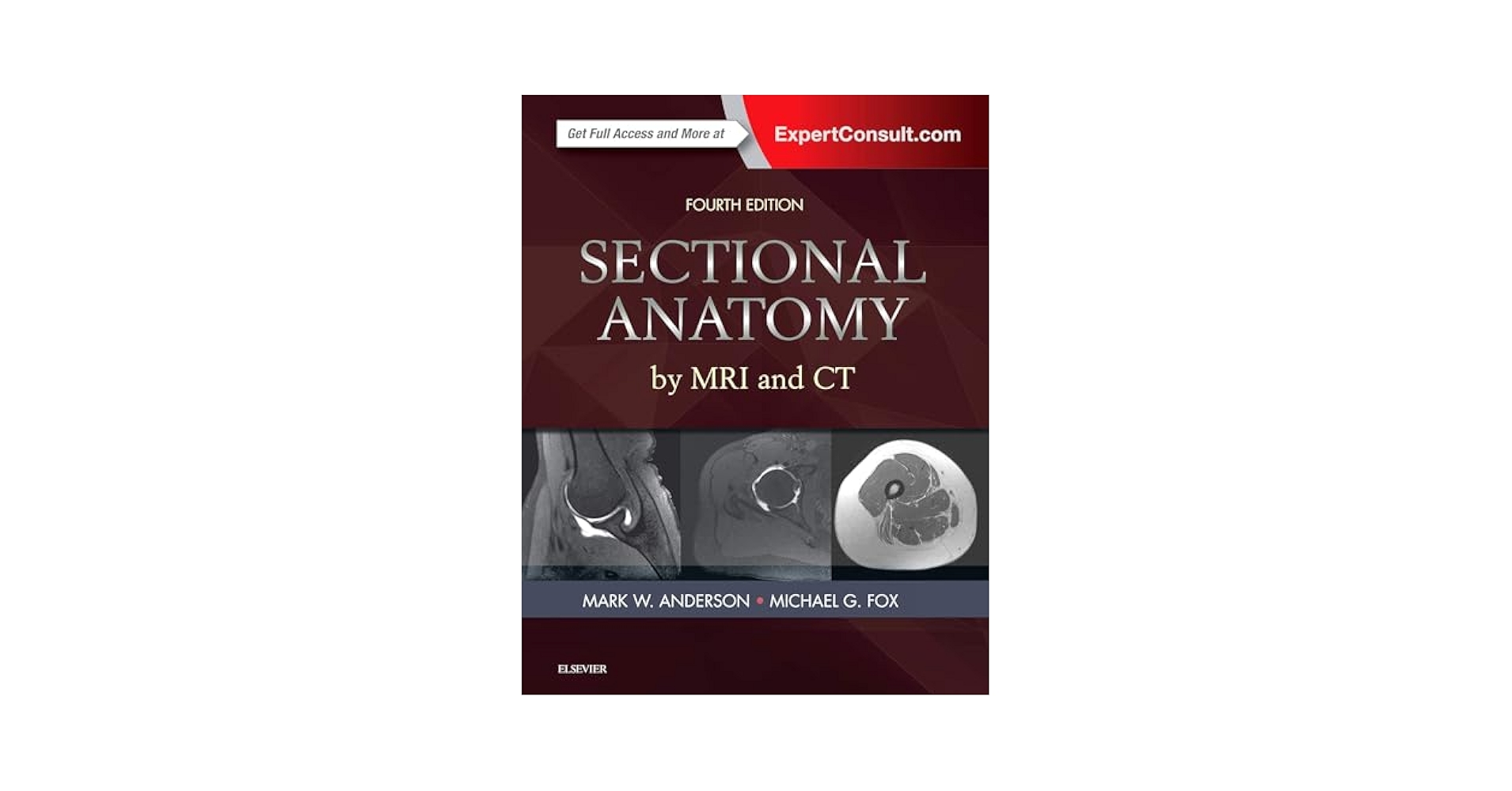 健康・医学 MRI ARTHROSCOPY and SURGICAL ANATOMY 健康・医学