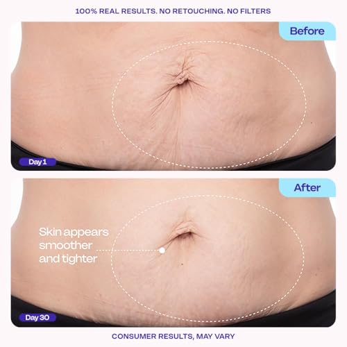 GOPURE Tighten & Smooth Belly Cream - Clinically Tested with MicroTight4 Complex to Reduce the Appearance of Cellulite & Stretch Marks - Quick Absorbing for Smoother, Firmer-Looking Skin, 4.25oz — view 3