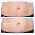 GOPURE Tighten & Smooth Belly Cream - Clinically Tested with MicroTight4 Complex to Reduce the Appearance of Cellulite & Stretch Marks - Quick Absorbing for Smoother, Firmer-Looking Skin, 4.25oz
