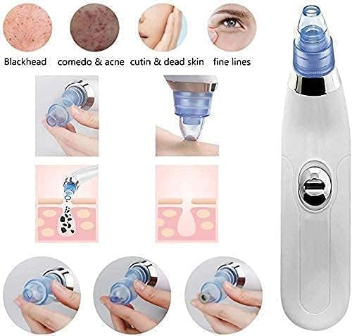 Image of 4 In 1 Multi-Function Blackhead Whitehead Extractor Remover Device Facial Cleansing Tool,Skin Cleaner,Pimple Removal Tool,Acne Pimple Pore Cleaner Vacuum Suction Tool For Men & Women