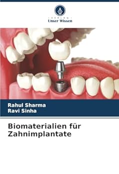 Paperback Biomaterialien für Zahnimplantate [German] Book