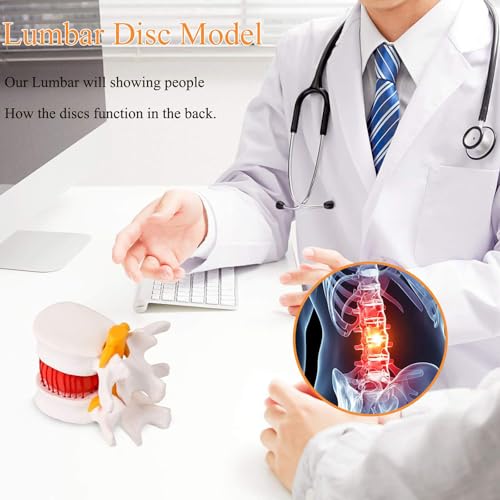 Modèle de disque hernié lombaire AMITD pour expliquer la compression nerveuse - 8