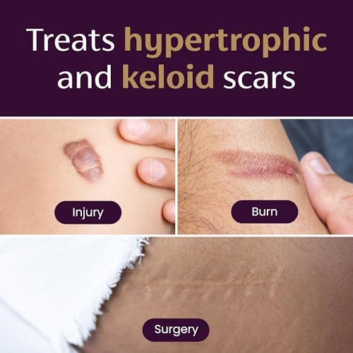 mederma medical grade silicone scar sheets - improves appearance of old amp new scars from injury burn amp surgery breathable amp flexible 4 count