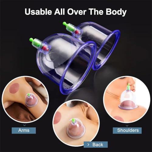 Electric Cupping Set – Battery-Powered Handheld Vacuum Suction Cups for Body Back Massage, Anti-Cellulite Massage Cupping Jars miniatura 5