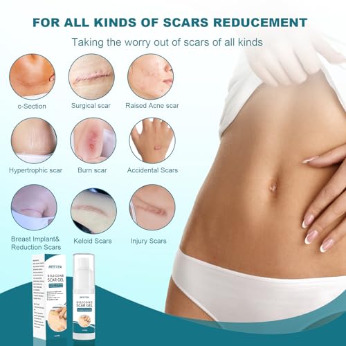 BESTEK Scar Cream, Advance Scar Gel for Surgical Scars,Face,Body,Leg, Burns, Acene,C-Section, Stretch Marks, Keloids,Scar Treatments for Old & New Scars,Scar Removal for Women Men,1.76oz/50ml