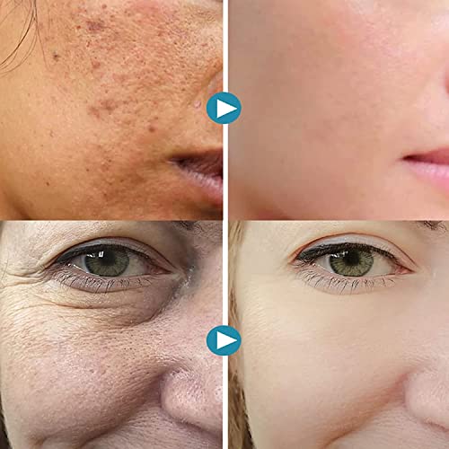 Donubiiu 2023 New Magical Pore Eraser Waterproof