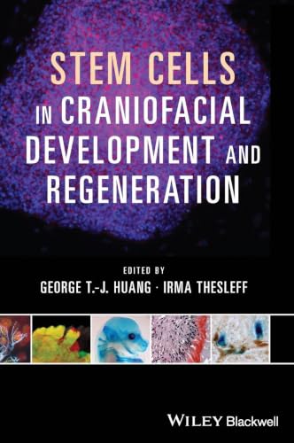 Stem Cells in Craniofacial Development and Regeneration