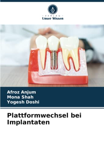 Plattformwechsel bei Implantaten: DE ...