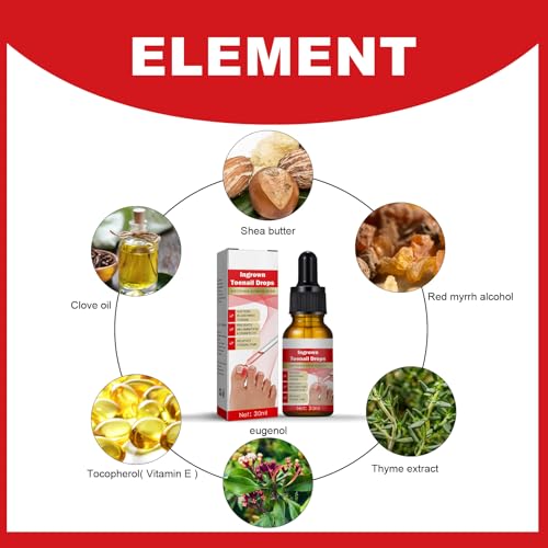 Eingewachsene Zehennägel Behandlung - 30ml Eingewachsene Zehennägel - Nagelhautpflege Öle für eingewachsene Zehennägel