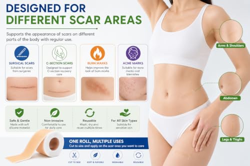 Image of Silicone Scar Sheets Roll 4cm x 1.5m, Reusable Silicone Gel Tape for Scar Care, Cut to Size for Surgical, C-Section, Burn & Acne Marks, Washable Scar Sheet
