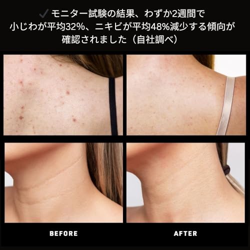faq 211-8 light neck amp dcollet mask - wireless amp lightweight silicone masks - flexible-fit amp full coverage - wearable skin care