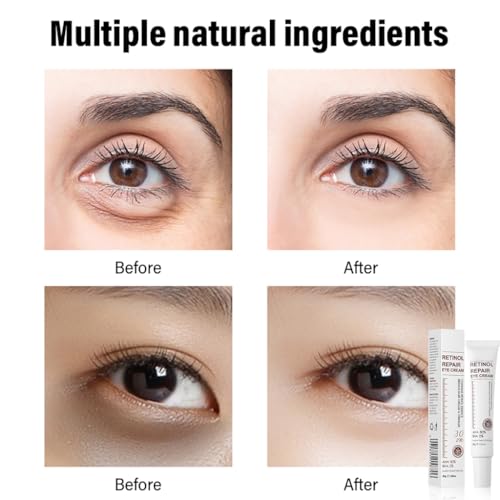Retinol Eye Cream, Retinol Serum Eye Cream for Dark Circles and Puffy Eyes, Eye Cream with Retinol & AHA 30% & BHA 2% & Hyaluronic Acid for Fine Lines & Wrinkles Saggy Skin Puffy Eyes - Image 5