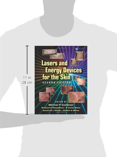 Lasers and Energy Devices for the Skin
