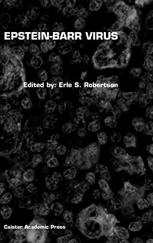 Epstein-Barr Virus view 2