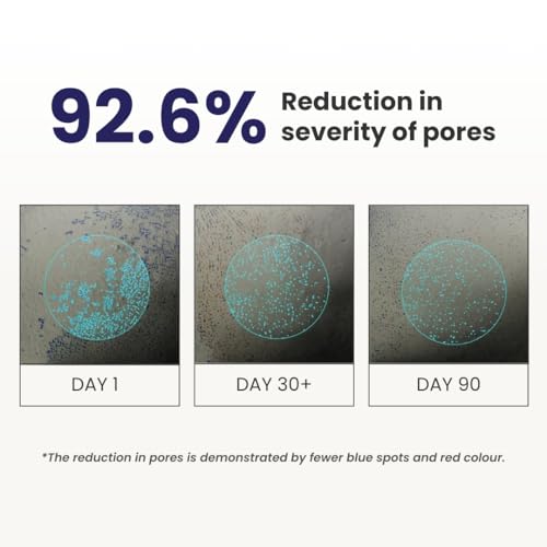 Image of RE' EQUIL 0.3% Retinol Night Cream, Improves Skin Texture, Reduces Acne, Unisex, For All Skin Types, 32G