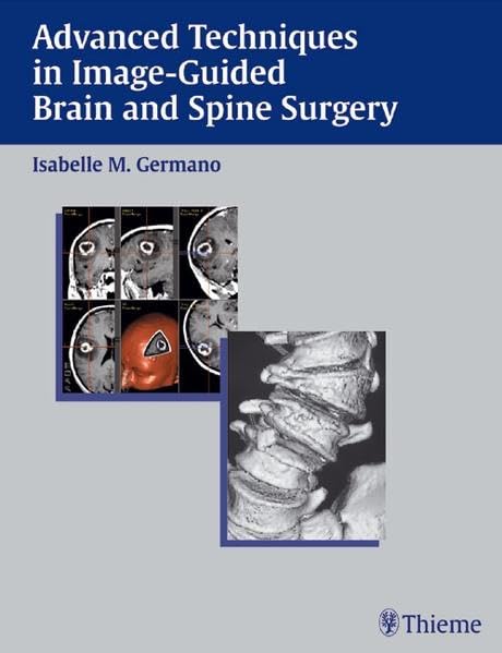 Buy Advanced Techniques in Image-guided Brain and Spine Surgery — BookShops.in