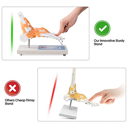 Ultrassist UL0001 Human Foot Joint Model thumb #2