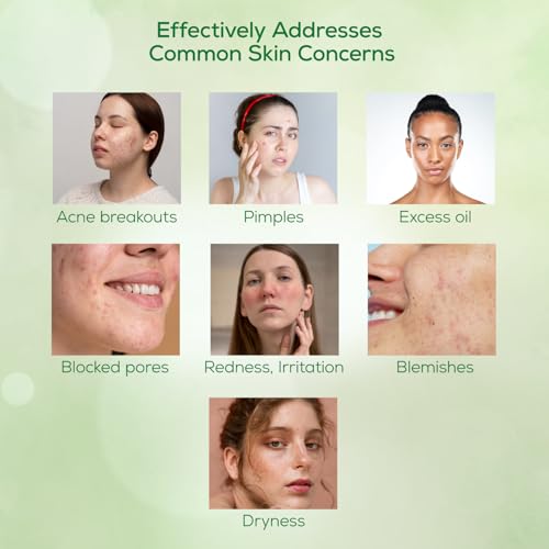 Image of Pil Neem Plus Face Wash Gel | Face Wash Gel for Acne, Pimpled & Oily Skin | Clear & Smooth Radiant Skin | 50 gms each (Pack of 4)