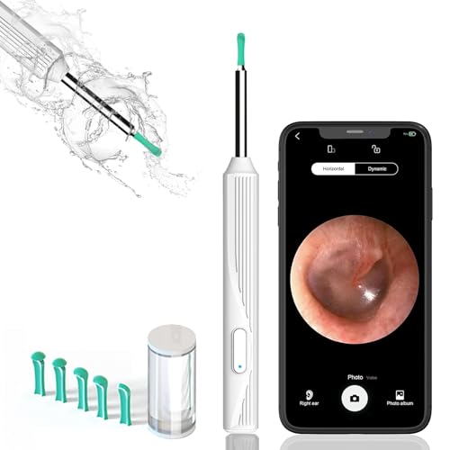 Ear cleaner with camera, Earwax Remover kit, 1080P FHD Wireless Ear Otoscope with 6 LED Lights, ear wax removal with 8 Pcs Ear Set, ear cleaning kit for iPhone, iPad, Android Phones(white)