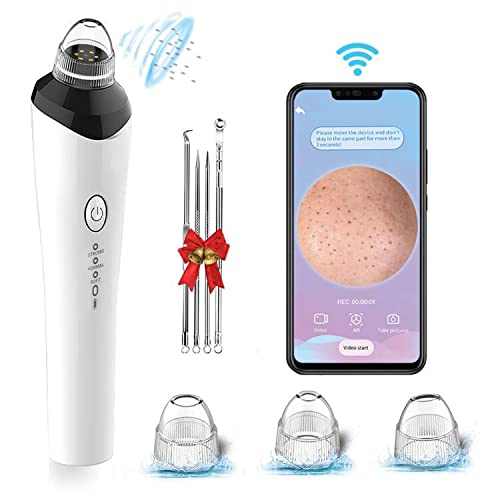 2022 Newest Blackhead Remover Vacuum with 20X Camera, WiFi Blackhead Pore Vacuum, USB Rechargeable Electric Facial Pore Cleaner with Blackhead Remover Comedone Extractor Acne Removal Kit