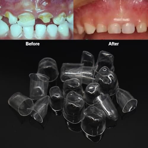 Image of 64 Pcs Deciduous Transparent Crowns Kit,Dental Temporary Crown for Anterior Teeth,Dental Materials