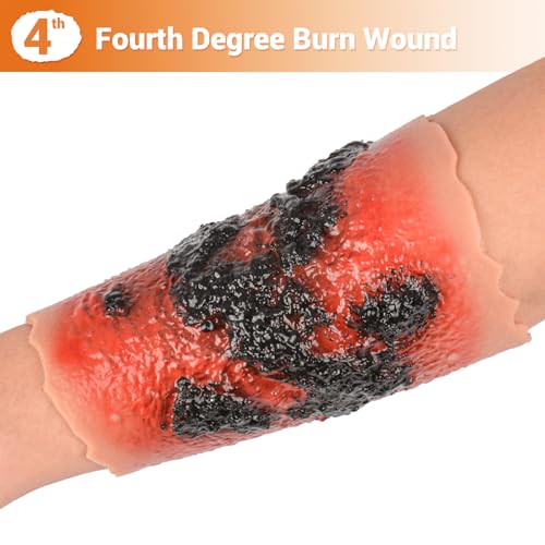 Image of Burn Wound Packing Trainer, Burn Moulage, Adhesive Skin Burn Wound Trainer for Wound Care Training, Fourth Degree Burn Wound Training Model