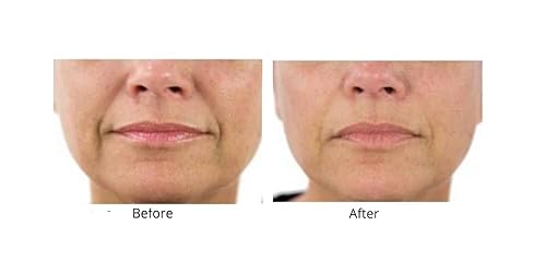 Miniatura 6 de Dr. Sevinor's NUEVA Solución Genuina de Lifting Facial Concentrado Sérum Arranca la Piel Cansada, Disminuye las ArrugasLíneas Renueva la Elasticidad