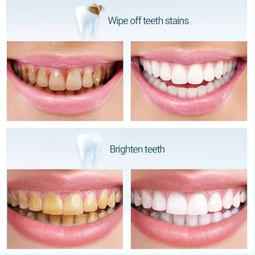 CFEWV 1 Schachtel Zahn Schleifpapier, Zahnschleifpapier Für Zwischenräume, Zahnschleifpapier Für Enge Zwischenräume, Dental Schleifstreifen, Zähne Polieren Finishing Gloss Zahnsteinentferner