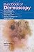 Handbook of Dermoscopy