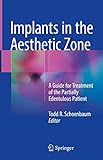 Implants in the Aesthetic Zone: A Guide for Treatment of the Partially Edentulous Patient