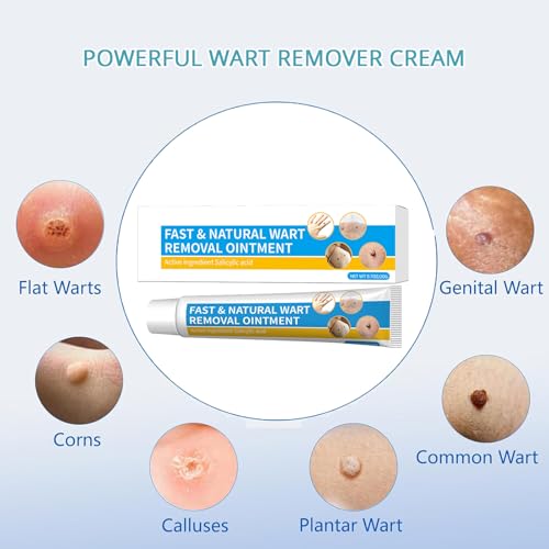 Image of Wart Remover Cream with Salicylic Acid, Freeze Off Fast-Acting Wart Remover Ointment for Warts, Plantar Warts, Common Warts, Flat Warts, Corns, Calluses