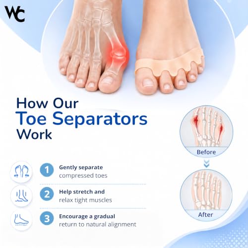 Image of WC Silicone Toe Separator for Feet|Gel Toe Corrector|Bunion Support|Beige