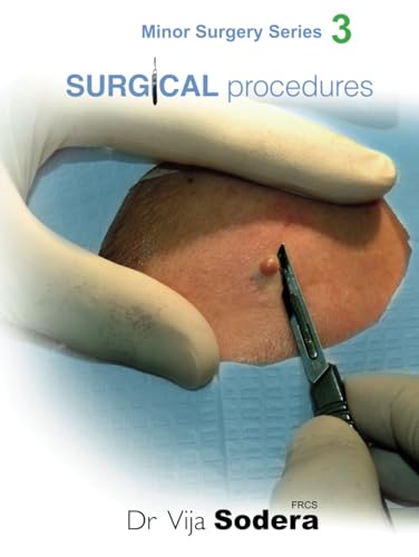 Surgical Procedures (Minor Surgery Series) by Dr Vija Sodera FRCS