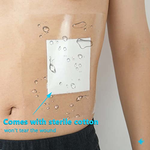 20 Pcs Waterproof Bandage Waterproof Shower Cover Shields For Dialysis Port (7.8" X 7.8"), Ostomy Shower Protector Adhesive Stoma Clear Film Dressing Colostomy Protector With Non-Adhesive Center Pad #TOP1