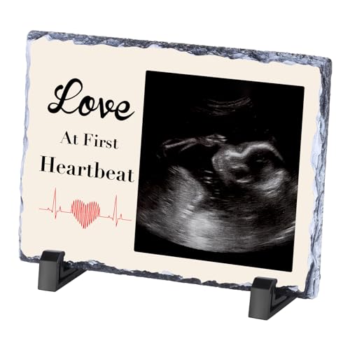 WACAR Custom Sonogram Picture Frame, Personalized Ultrasound Photo Frames for Pregnancy Announcement, Keepsake Nursery Decor for Baby Showers Customized Gifts for Expecting Mom