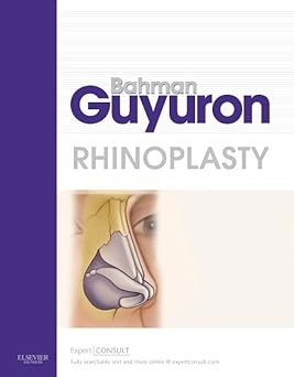 Rhinoplasty  