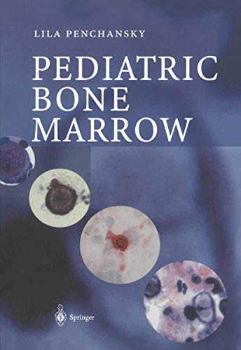 Pediatric Bone Marrow view 2