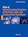 Atlas of Normal Imaging Variations of the Brain, Skull, and Craniocervical Vasculature