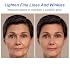 Box face serum Facial Serum 1 Fl Oz, Anti Aging Serum For Face, Instant Face Tightening, Reduce Fine Lines, Wrinkles, Boost Skin Collagen, Hydrate & Plump Skin (2 Box)