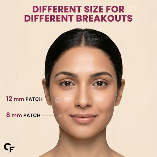 Image of Carbamide Forte Pimple Patches for Face Salicylic Acid & Cica | 72 Hydrocolloid Acne Patch | Invisible Waterproof Pimple Patch Absorbs Pus & Impurities for All Skin Types