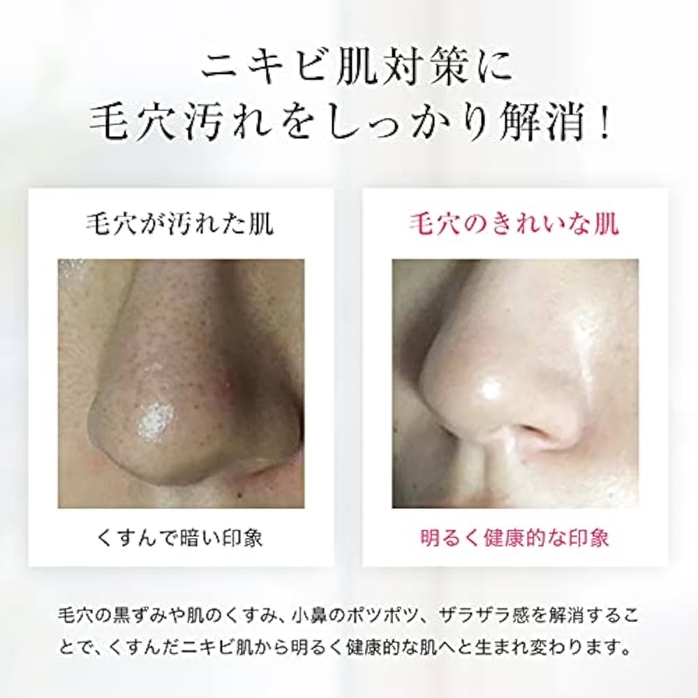 Amazon | スキンベビー サリチル酸 洗顔フォーム 150g 薬用