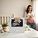 Kate & Milo Baby Sonogram Photo Frame, I Can't Wait To Meet You Ultrasound Keepsake, Ideal Pregnancy Announcement, Nursery Décor, Girl and Boy Gift, Gray
