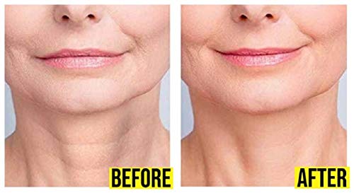 Hoosh Face Silicone Pads for Wrinkles (6 Pcs, Reusable), Overnight Hydrating Anti Aging Patches, Botox Tape for Neck, Forehead, Eyes & Smile Lines Treatment, Face & Under Eye Smoothing Mask For Women