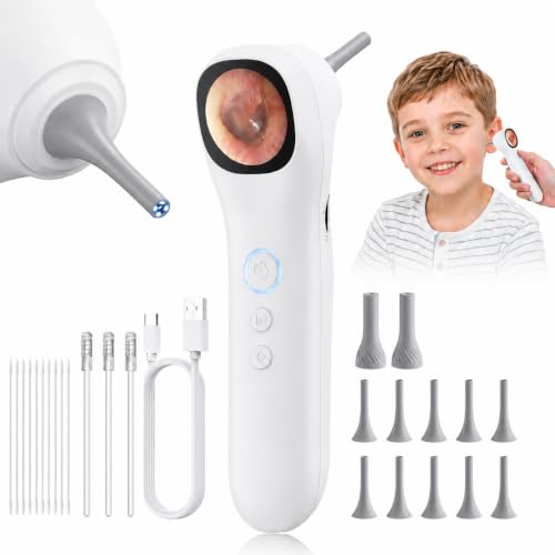 Image of Otoscope Ear Camera with 1.21 inch Screen, 1080P Ear Scope with 4 LED Lights, Otoscope Camera for Adults, Support Photo & Video, Type-C Charging with Computers, Baby Essentials, Home Medical | 1.21 inch Screen for real-time viewing. Capture photos and videos, Connect to PC, Type-C rechargeable.