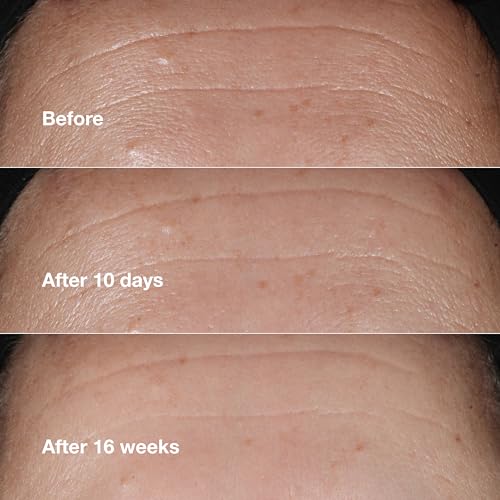 Clinique I0142120 Smart Clinical Repair Wrinkle Correcting Face Serum thumb #3