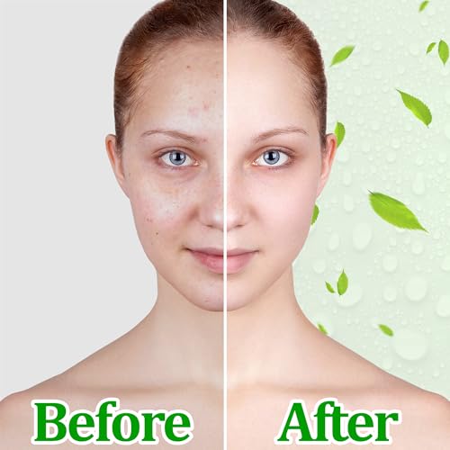 Generic Elegant Royale Aloe 99% Fresh Moisture Soothing Gel 2 Pack - Face Body Moisturizer- Hydrating Cooling Skincare for Sensitive Sunburned Skin, 9oz, 250ml