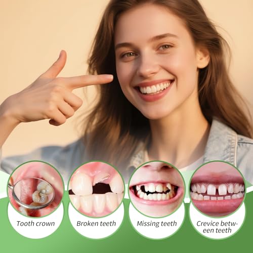 Image of Tooth Repair kit for Filling The Missing Broken Tooth and Gaps-Moldable Fake Teeth and Thermal Beads Replacement Kit-White-004