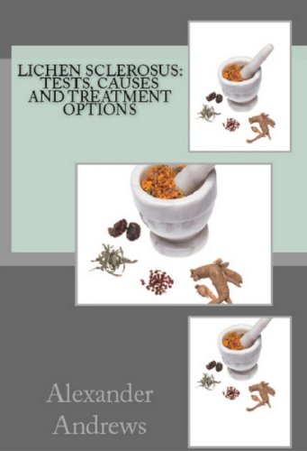 Lichen Sclerosus: Tests, Causes and Treatment Options