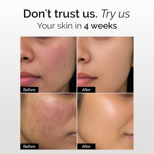 Image of Personal Touch Complete Trial Kit - Dry Defence Therapy for Dry & Sensitive Skin | Cetabath Face Cleanser, Snail Mucin Serum, Skindam Barrier Repair Moisturizer & SPF 50 Sunscreen